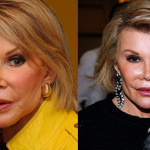 Joan Rivers’ Face!