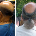 Balding men with ponytails!